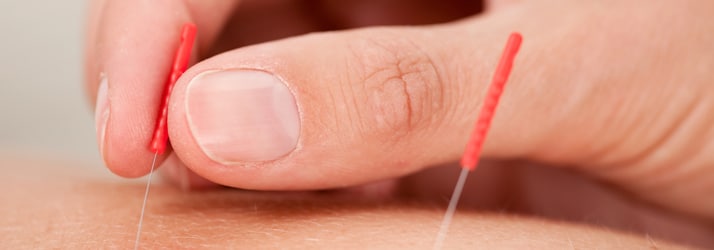 Chiropractic Temple TX Acupuncture Faqs Chiropractic Temple TX Acupuncture Faqs
