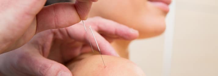 Chiropractic Temple TX What is Acuptuncture Chiropractic Temple TX What is Acuptuncture